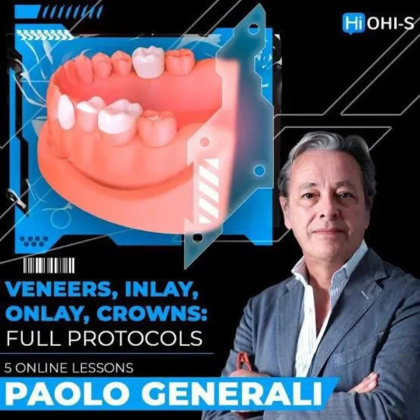 OHI-S Veneers, inlay, onlay, crowns: full protocols