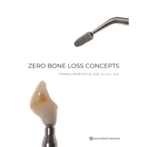 Zero Bone Loss Concepts