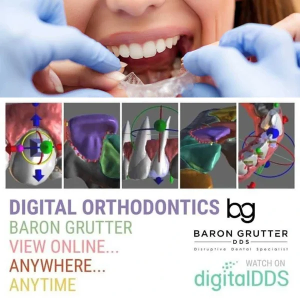 Digital Orthodontics (Clear Aligners) Digital Orthodontics (Clear Aligners)