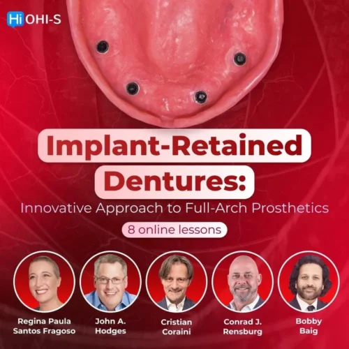 OHI-S Implant-Retained Dentures Innovative Approach to Full-Arch Prosthetics OHI-S Implant-Retained Dentures Innovative Approach to Full-Arch Prosthetics