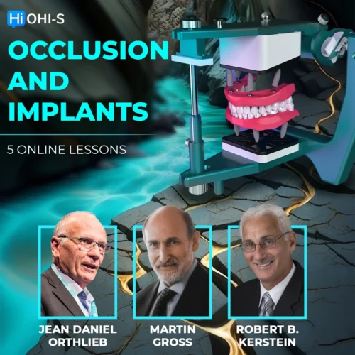 OHI-S Occlusion and Implants – Robert B. Kerstein, Jean Daniel Orthlieb, Martin Gross OHI-S Occlusion and Implants – Robert B. Kerstein, Jean Daniel Orthlieb, Martin Gross