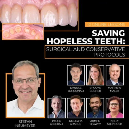 OHI-S Saving Hopeless Teeth, Surgical and Conservative Protocols OHI-S Saving Hopeless Teeth, Surgical and Conservative Protocols